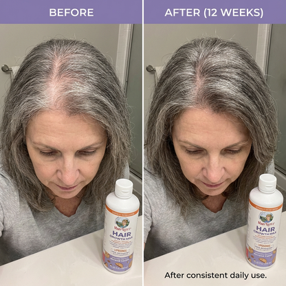 Nivoro™  - Hair Growth Max