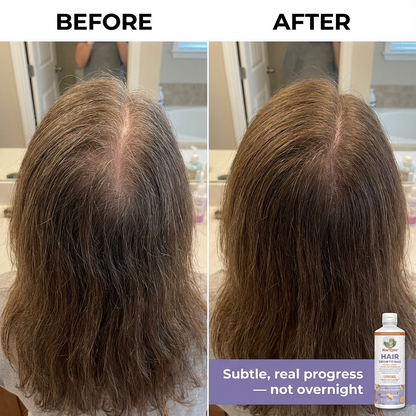 Nivoro™  - Hair Growth Max