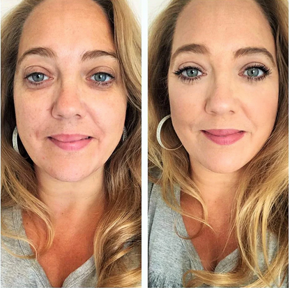 Nivoro™ - NMN Complex