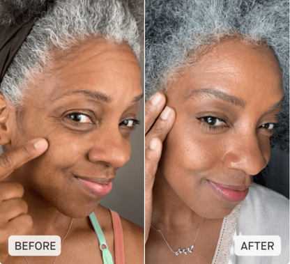 Nivoro™ - NMN Complex