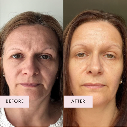 Nivoro™ - NMN Complex