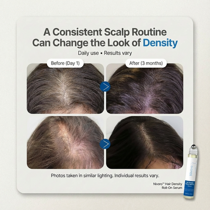 Nivoro™ - Hair Density Roll-on Serum