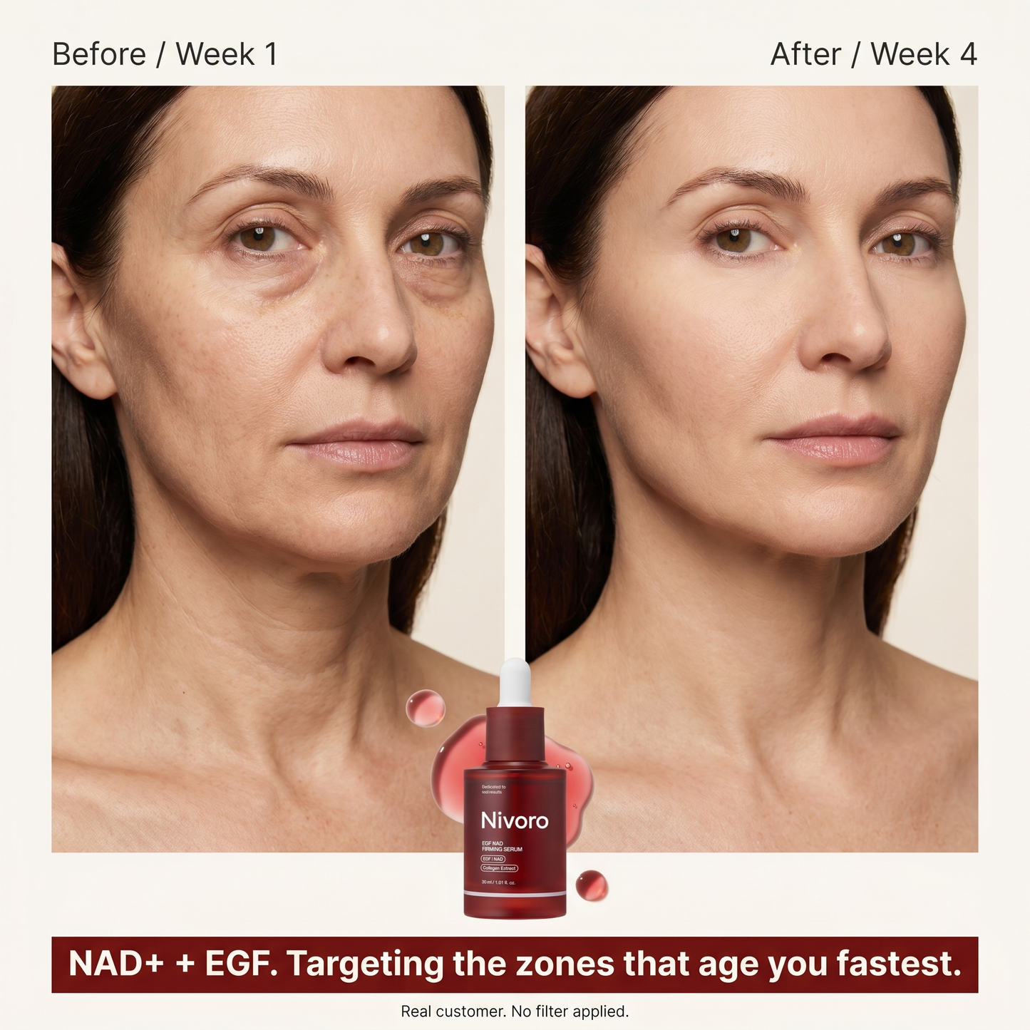 Nivoro™ - NAD Firming Serum